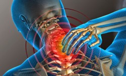 Dolor de Cuello y su relación emocional Causas emocionales del dolor de cuello