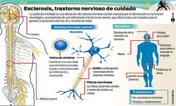Causas emocionales de la Esclerosis Causas emocionales de la esclerosis