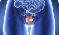 Causas Emocionales del Prolapso Causas emocionales del Prolapso